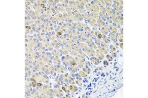 Immunohistochemistry of paraffin-embedded mouse stomach using GLS antibody at dilution of 1:100 (x40 lens). (Glutaminase 抗体)