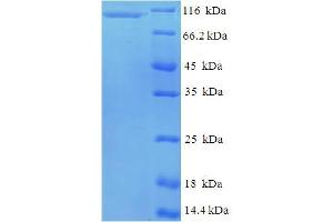 SDS-PAGE (SDS) image for Guanine Nucleotide Binding Protein Like Protein 2 (GNL2) (AA 1-731), (full length) protein (His-SUMO Tag) (ABIN5711275)