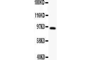 Anti- DISC1 antibody,  Western blotting All lanes: Anti DISC1 () at 0. (DISC1 抗体  (N-Term))