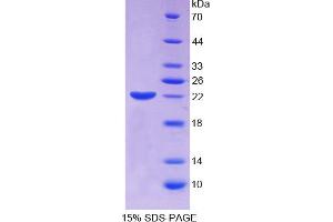 SDS-PAGE analysis of Human ECT2 Protein. (ECT2 蛋白)