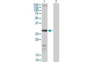SLC39A3 antibody  (AA 1-314)