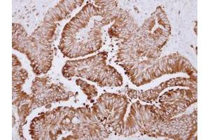 Image no. 1 for anti-Carboxylesterase 2 (CES2) (AA 310-522) antibody (ABIN1497478) (CES2 抗体  (AA 310-522))