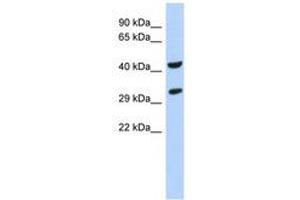 Image no. 1 for anti-Ankyrin Repeat and SOCS Box Containing 8 (ASB8) (N-Term) antibody (ABIN6741136) (ASB8 抗体  (N-Term))