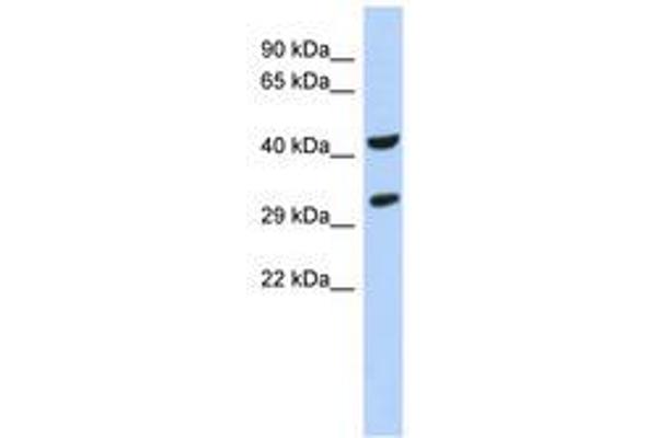 ASB8 antibody  (N-Term)