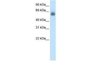 WB Suggested Anti-GRHL3 Antibody Titration: 0. (GRHL3 抗体  (C-Term))