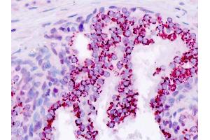 Human, Prostate: Formalin-Fixed Paraffin-Embedded (FFPE) (APRT 抗体  (AA 149-179))