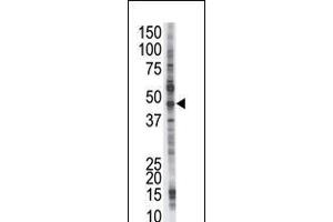 Antibody is used in Western blot to detect PSMD4 in Jurkat cell lysate. (PSMD4/ASF 抗体  (C-Term))