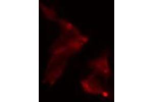 ABIN6275084 staining  LOVO cells by IF/ICC. (RNF111 抗体  (C-Term))