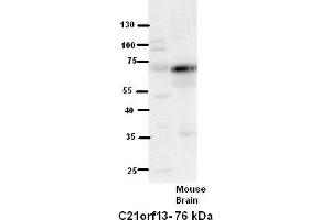 WB Suggested Anti-C21orf13 Antibody Titration:  5% Milk  ELISA Titer:  dilution: 1:500  Positive Control:  Mouse Brain lysate (LCA5L 抗体  (N-Term))