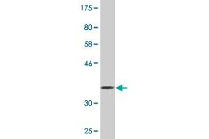 Western Blot detection against Immunogen (36. (EPH Receptor B1 抗体  (AA 221-320))