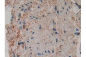 Immunohistochemistry (IHC) image for anti-Phospholipase A2, Group IVA (Cytosolic, Calcium-Dependent) (PLA2G4A) (AA 563-749) antibody (ABIN7438268)
