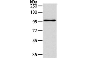 Western blot analysis of Hela cell using EPHA3 Polyclonal Antibody at dilution of 1:400 (EPH Receptor A3 抗体)