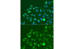 Immunofluorescence analysis of A549 cell using ATF3 antibody. (ATF3 抗体  (AA 1-181))
