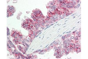 Human Prostate: Formalin-Fixed, Paraffin-Embedded (FFPE). (ATG4B 抗体  (AA 110-159))