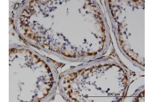 Immunoperoxidase of monoclonal antibody to RND3 on formalin-fixed paraffin-embedded human testis. (RND3 抗体  (AA 1-244))