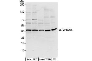 Western Blotting (WB) image for anti-Vacuolar Protein Sorting-Associated Protein 26A (VPS26A) (AA 277-327) antibody (ABIN7452992)