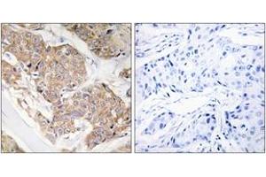 Immunohistochemistry (IHC) image for anti-Interleukin 13 Receptor, alpha 1 (IL13RA1) (AA 371-420) antibody (ABIN2888882) (IL13 Receptor alpha 1 抗体  (AA 371-420))