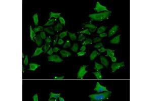 Immunofluorescence analysis of HeLa cells using ALAS1 Polyclonal Antibody (ALAS1 抗体)