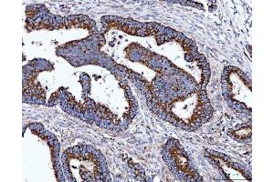 IHC analysis of TOMM40 using anti-TOMM40 antibody (ABIN7599738).