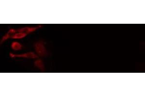 ABIN6277013 staining  HeLa cells by IF/ICC. (IFI16 抗体  (C-Term))
