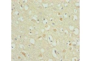 Immunohistochemistry of paraffin-embedded human brain tissue using ABIN7168273 at dilution of 1:100 (A2BP1 抗体  (AA 1-130))