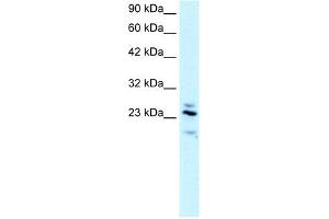 RGS20 antibody used at 2. (RGS20 抗体  (Middle Region))