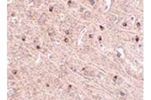 Immunohistochemistry of TOM70 in mouse brain tissue with this product at 2. (TOM70 抗体  (Center))