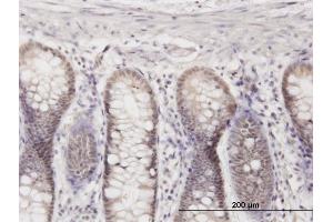 Immunoperoxidase of monoclonal antibody to CRSP8 on formalin-fixed paraffin-embedded human colon. (MED27 抗体  (AA 1-70))