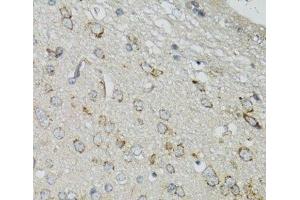 Immunohistochemistry of paraffin-embedded Mouse brain using DGUOK Polyclonal Antibody at dilution of 1:100 (40x lens). (Deoxyguanosine Kinase 抗体)