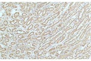 Immunohistochemistry of paraffin-embedded Human kidney tissue using ACTN1 Monoclonal Antibody at dilution of 1:200.