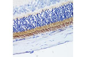 Immunohistochemistry of paraffin-embedded rat retina using PDE6B antibody (ABIN6132473, ABIN6145363, ABIN6145364 and ABIN6222688) at dilution of 1:200 (40x lens). (PDE6B 抗体  (AA 1-190))