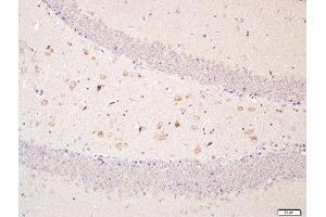 Paraformaldehyde-fixed, paraffin embedded mouse brain, Antigen retrieval by boiling in sodium citrate buffer (pH6. (OPTN 抗体  (AA 341-440))
