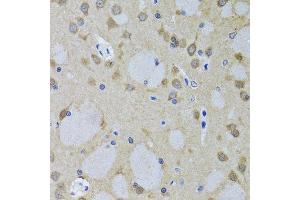 Immunohistochemistry of paraffin-embedded mouse brain using YWHAZ antibody. (14-3-3 zeta 抗体  (AA 1-100))