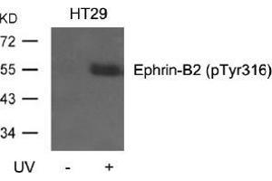 Western blot analysis of extracts from HT29 cells, untreated or treated with UV using Ephrin-B2 (Phospho-Tyr316). (Ephrin B2 抗体  (pTyr316))