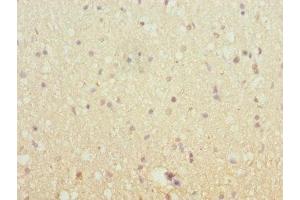 Immunohistochemistry of paraffin-embedded human brain tissue using ABIN7151640 at dilution of 1:100 (SH3G2 抗体  (AA 1-270))