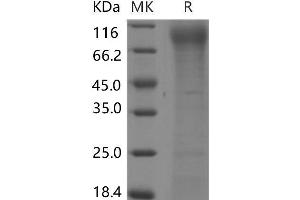 Western Blotting (WB) image for Fms-Related tyrosine Kinase 3 (FLT3) protein (His tag) (ABIN7320038)