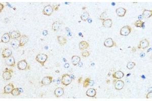 Immunohistochemistry of paraffin-embedded Mouse brain using Aromatase Polyclonal Antibody at dilution of 1:100 (40x lens). (Aromatase 抗体)