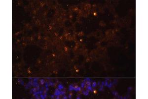 Immunofluorescence analysis of Mouse lung using IL1 beta Polyclonal Antibody at dilution of 1:100. (IL-1 beta 抗体)