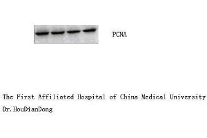 Western Blot (WB) analysis: Please contact us for more details. (PCNA 抗体)