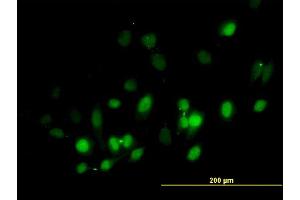Immunofluorescence of purified MaxPab antibody to BIRC5 on HeLa cell. (Survivin 抗体  (AA 1-142))