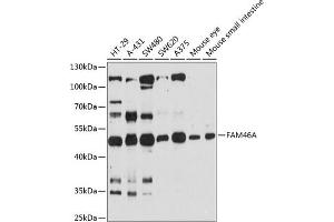 Western blot analysis of extracts of various cell lines, using FA antibody (ABIN6132080, ABIN6140461, ABIN6140462 and ABIN6216509) at 1:3000 dilution. (FAM46A 抗体  (AA 180-400))