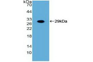 Detection of Recombinant FGFR3, Human using Polyclonal Antibody to Fibroblast Growth Factor Receptor 3 (FGFR3) (FGFR3 抗体  (AA 166-375))