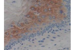 Immunohistochemistry (IHC) image for anti-serine Peptidase Inhibitor, Kazal Type 5 (SPINK5) (AA 734-995) antibody (ABIN7439546)