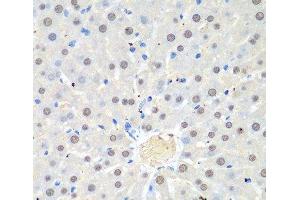 Immunohistochemistry of paraffin-embedded Rat liver using WDR48 Polyclonal Antibody at dilution of 1:100 (40x lens). (WDR48 抗体)