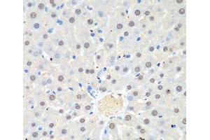 Immunohistochemistry of paraffin-embedded Rat liver using WDR48 Polyclonal Antibody at dilution of 1:100 (40x lens).