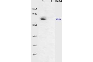 Lane 1: mouse embryo lysates Lane 2: rat brain lysates probed with Anti AVPR2 Polyclonal Antibody, Unconjugated (ABIN713231) at 1:200 in 4 °C. (RUNX2 抗体  (pSer451))