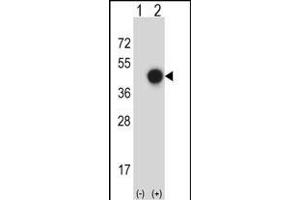 Western blot analysis of X (arrow) using rabbit polyclonal X Antibody (C-term) (ABIN657757 and ABIN2846739). (XPA 抗体  (C-Term))
