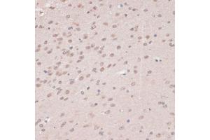 Immunohistochemistry of paraffin-embedded mouse brain using PRPF31 antibody (ABIN6132996, ABIN6146262, ABIN6146264 and ABIN6221399) at dilution of 1:100 (40x lens). (PRPF31 抗体  (AA 1-200))