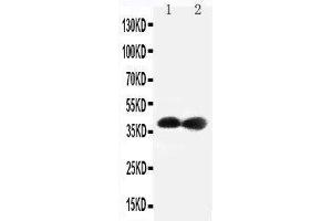 Anti-Cdk7 antibody,  Western blotting Lane 1: Rat Testis Tissue Lysate Lane 2: Rat Ovary Tissue Lysate (CDK7 抗体  (C-Term))