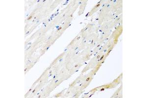 Immunohistochemistry of paraffin-embedded rat heart using VCP antibody (ABIN6290879) at dilution of 1:200 (40x lens). (VCP 抗体)